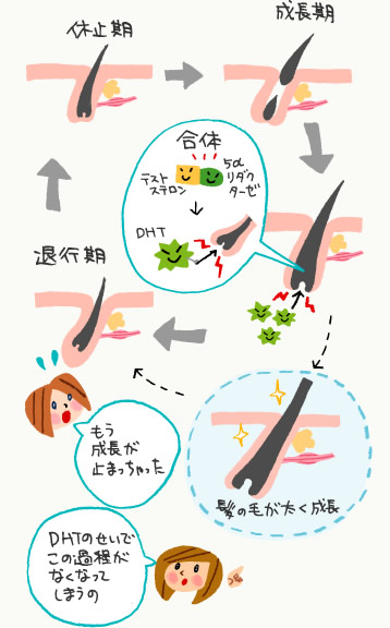 男性型脱毛のしくみ図解